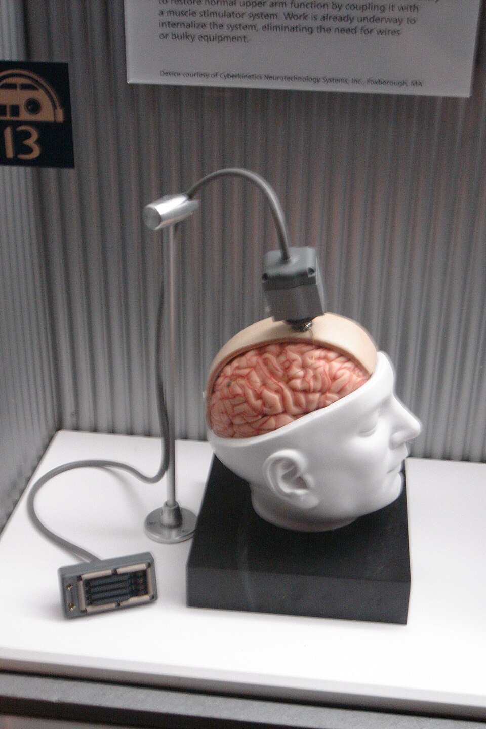 implante cerebral sobre tecido humano